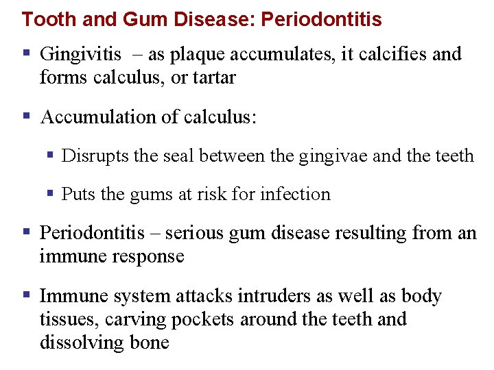 Tooth and Gum Disease: Periodontitis § Gingivitis – as plaque accumulates, it calcifies and