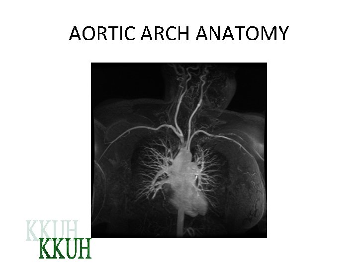 AORTIC ARCH ANATOMY 