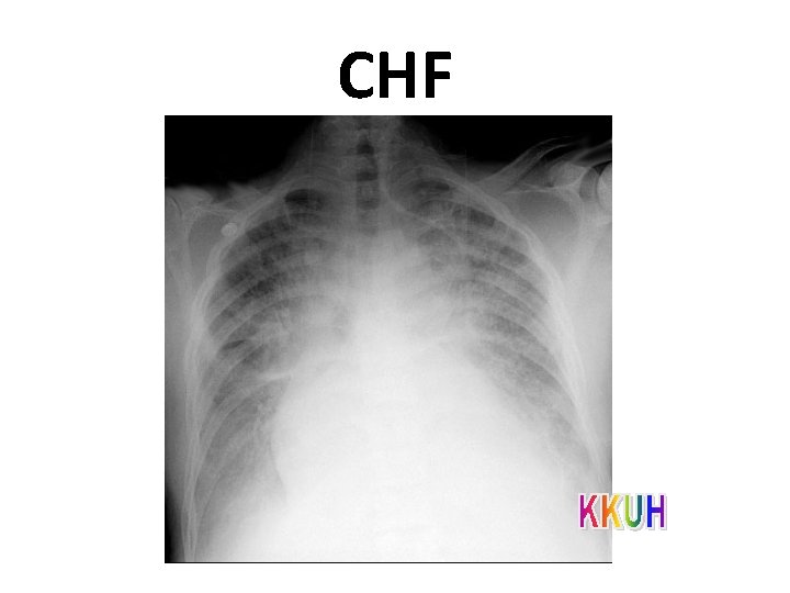 CHF 