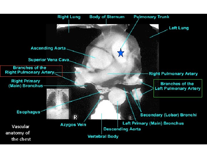 Vascular anatomy of the chest 