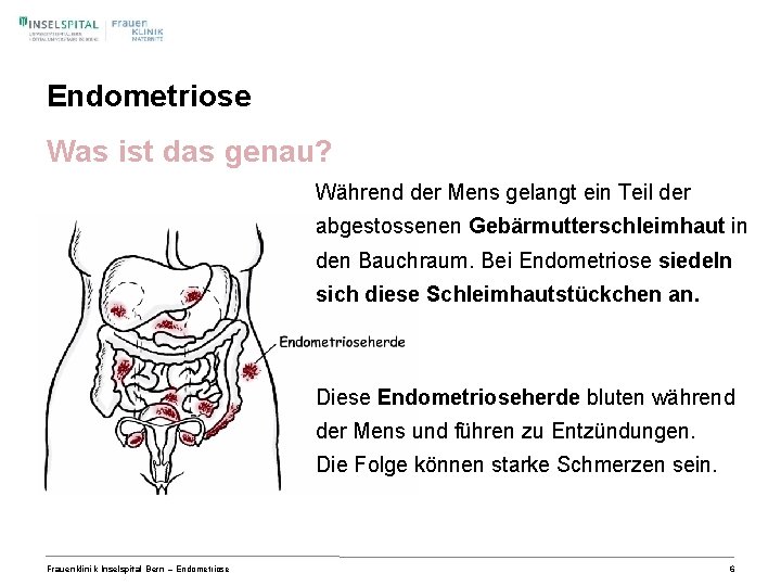 Endometriose Was ist das genau? Während der Mens gelangt ein Teil der abgestossenen Gebärmutterschleimhaut