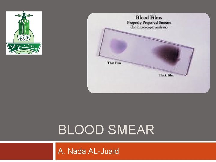 BLOOD SMEAR A. Nada AL-Juaid 