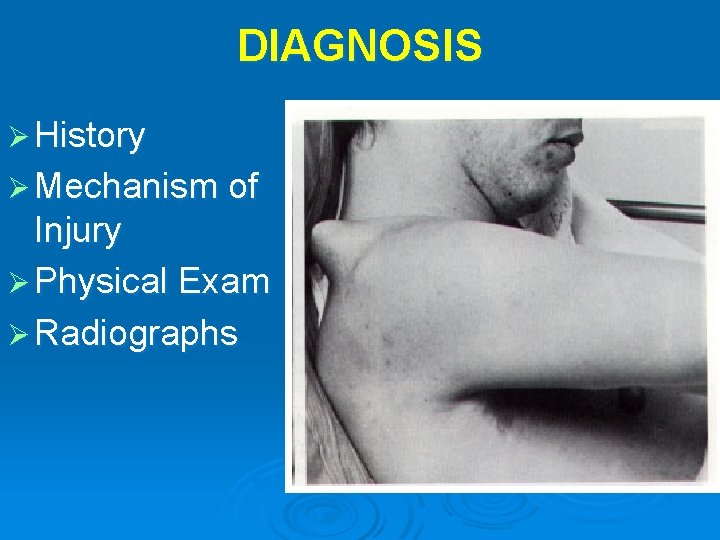 DIAGNOSIS Ø History Ø Mechanism of Injury Ø Physical Exam Ø Radiographs 