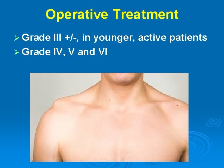 Operative Treatment Ø Grade III +/-, in younger, active Ø Grade IV, V and