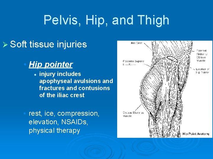 Pelvis, Hip, and Thigh Ø Soft tissue injuries • Hip pointer l injury includes