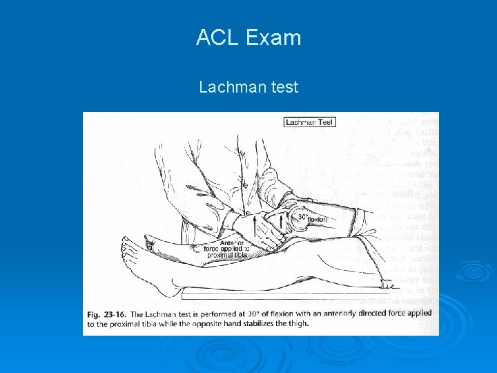 ACL Exam Lachman test 