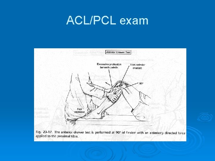 ACL/PCL exam 