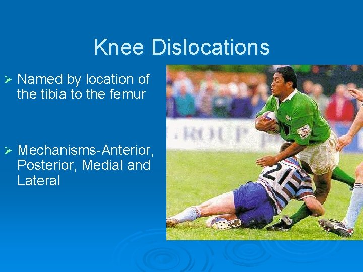 Knee Dislocations Ø Named by location of the tibia to the femur Ø Mechanisms-Anterior,