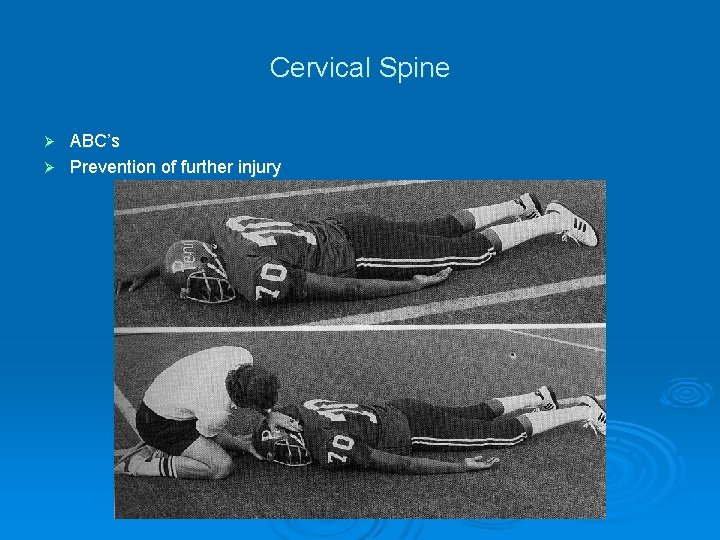 Cervical Spine ABC’s Ø Prevention of further injury Ø 