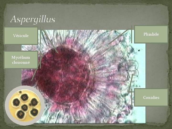 Aspergillus Vésicule Phialide Mycélium cloisonné Conidies 