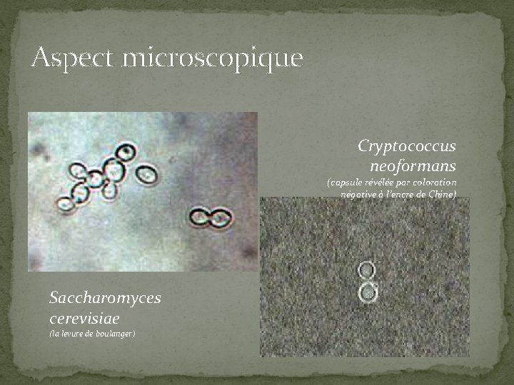 Aspect microscopique Cryptococcus neoformans (capsule révélée par coloration négative à l’encre de Chine) Saccharomyces