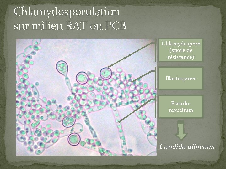 Chlamydosporulation sur milieu RAT ou PCB Chlamydospore (spore de résistance) Blastospores Pseudomycélium Candida albicans