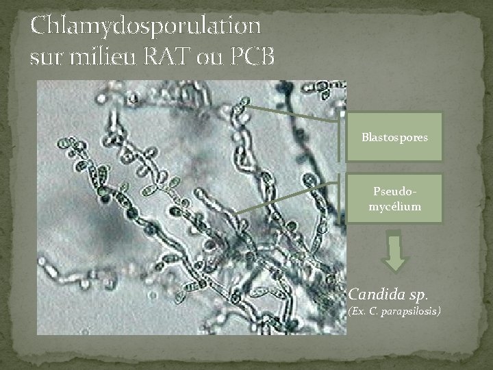 Chlamydosporulation sur milieu RAT ou PCB Blastospores Pseudomycélium Candida sp. (Ex. C. parapsilosis) 