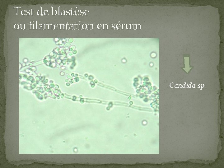 Test de blastèse ou filamentation en sérum Candida sp. 