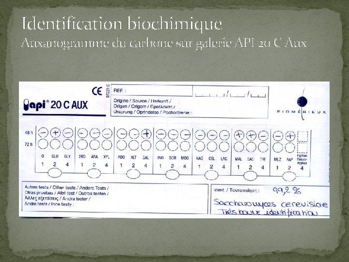 Identification biochimique Auxanogramme du carbone sur galerie API 20 C Aux 