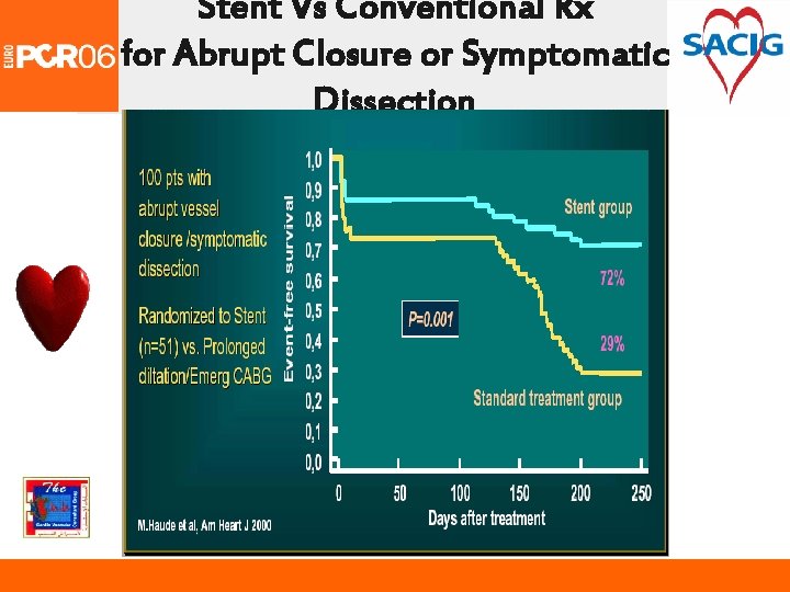 Stent Vs Conventional Rx for Abrupt Closure or Symptomatic Dissection 