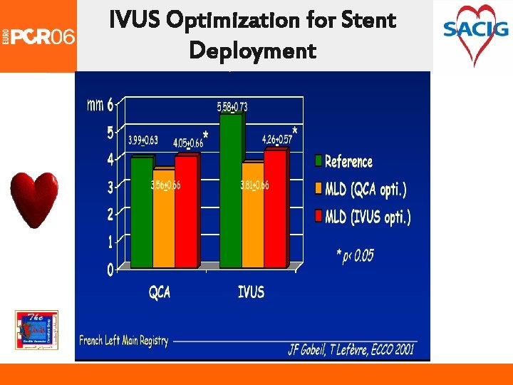 IVUS Optimization for Stent Deployment 