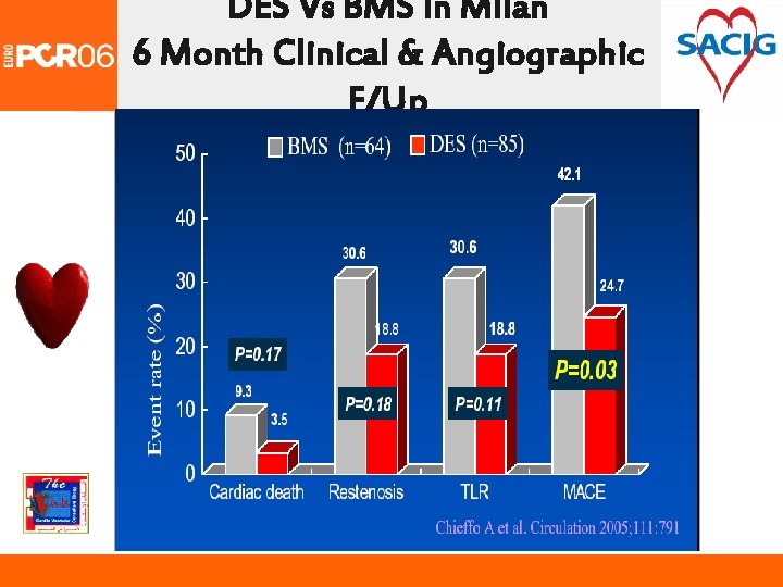 DES Vs BMS in Milan 6 Month Clinical & Angiographic F/Up 