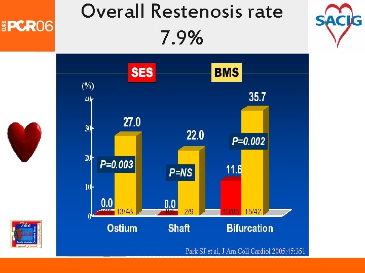 Overall Restenosis rate 7. 9% 