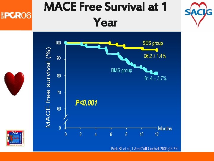 MACE Free Survival at 1 Year 