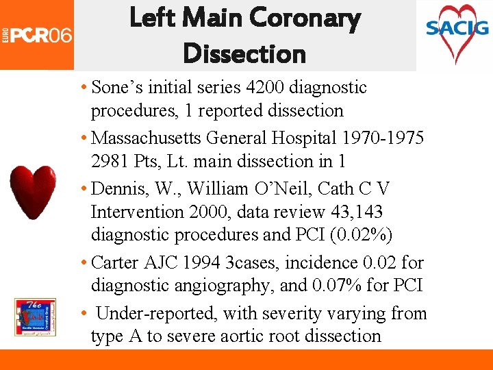 Left Main Coronary Dissection • Sone’s initial series 4200 diagnostic procedures, 1 reported dissection
