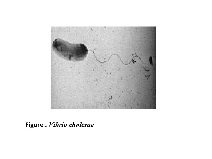 Figure. Vibrio cholerae 