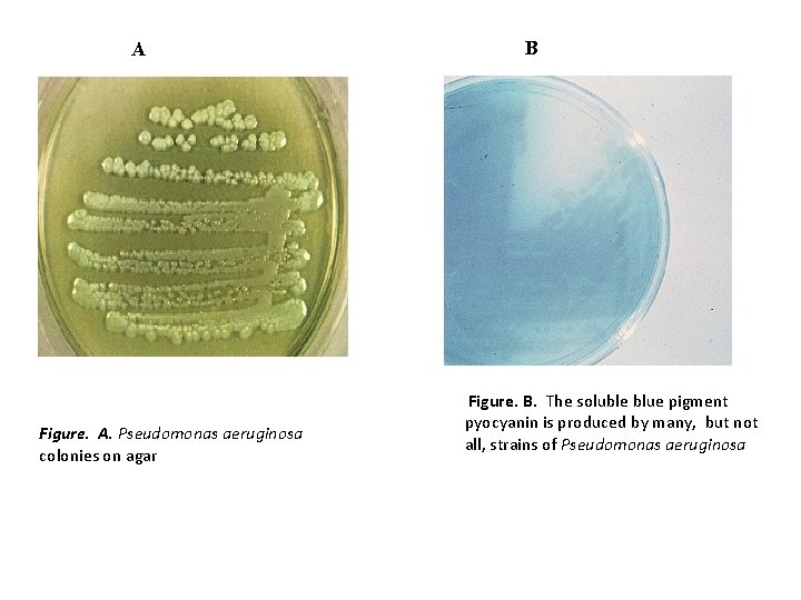 A Figure. A. Pseudomonas aeruginosa colonies on agar B Figure. B. The soluble blue