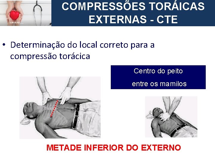 COMPRESSÕES TORÁICASC CIRCULAÇÃO – Compressões EXTERNAS - CTE Torácicas European Resuscitation Council • Determinação