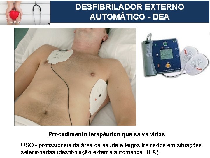 European Resuscitation Council DESFIBRILADOR EXTERNO AUTOMÁTICO - DEA Procedimento terapêutico que salva vidas USO