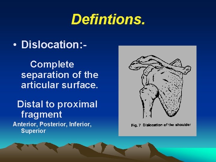 Defintions. • Dislocation: Complete separation of the articular surface. Distal to proximal fragment Anterior,