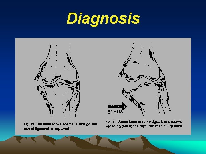 Diagnosis 