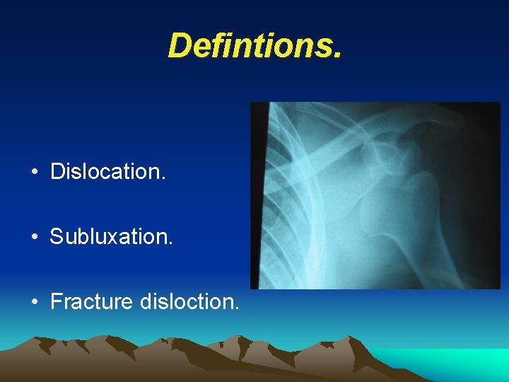 Defintions. • Dislocation. • Subluxation. • Fracture disloction. 