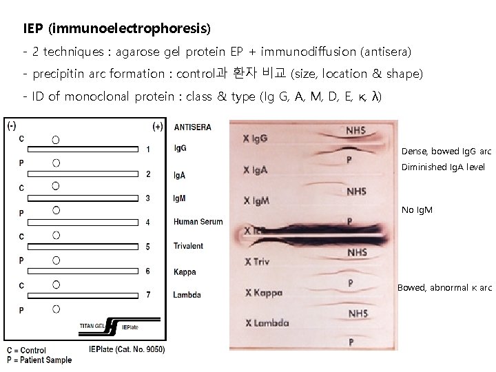 IEP (immunoelectrophoresis) - 2 techniques : agarose gel protein EP + immunodiffusion (antisera) -