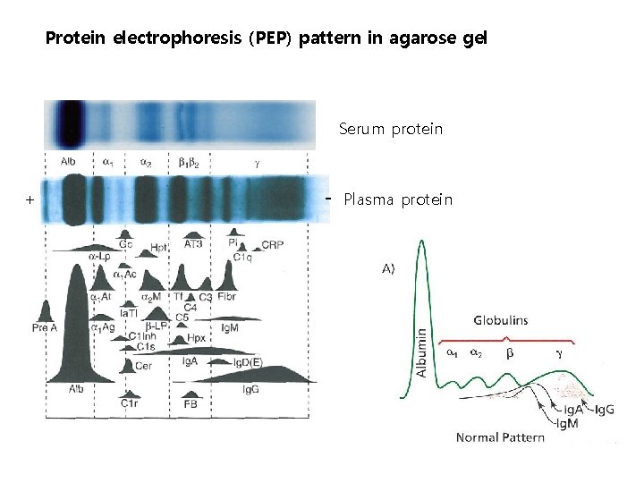 Protein electrophoresis (PEP) pattern in agarose gel Serum protein + - Plasma protein 