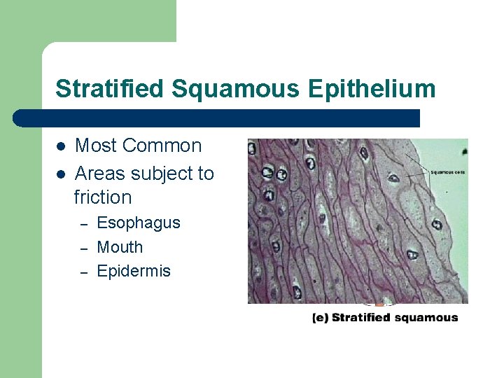 Stratified Squamous Epithelium l l Most Common Areas subject to friction – – –