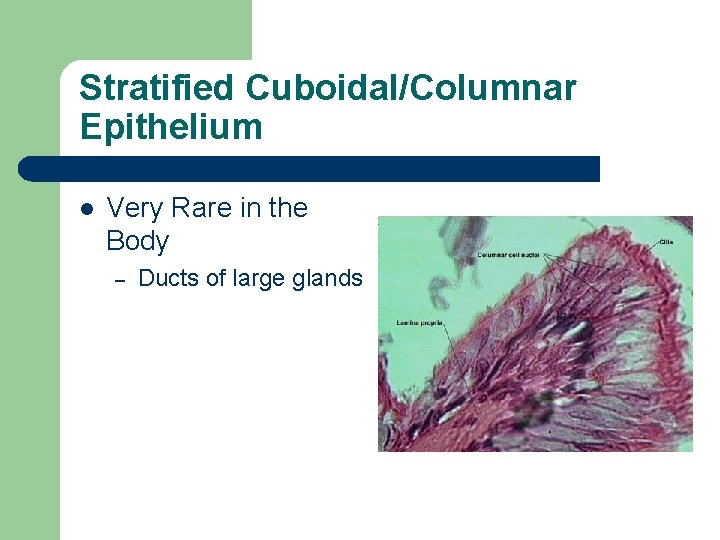 Stratified Cuboidal/Columnar Epithelium l Very Rare in the Body – Ducts of large glands