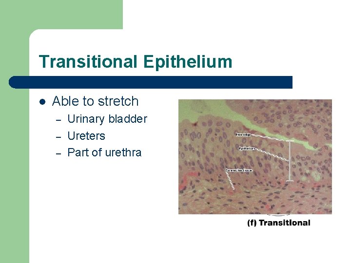 Transitional Epithelium l Able to stretch – – – Urinary bladder Ureters Part of