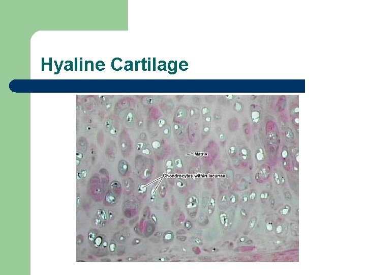 Hyaline Cartilage 