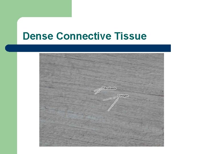 Dense Connective Tissue 