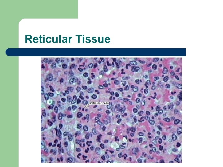 Reticular Tissue 