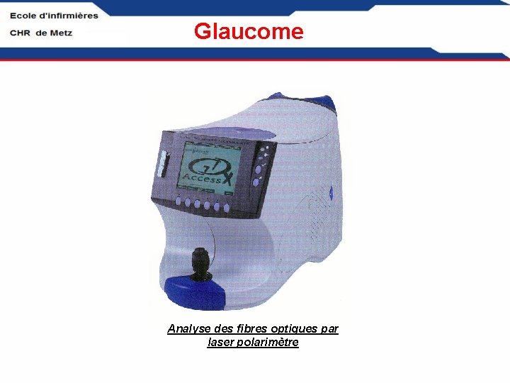 Glaucome Analyse des fibres optiques par laser polarimètre 