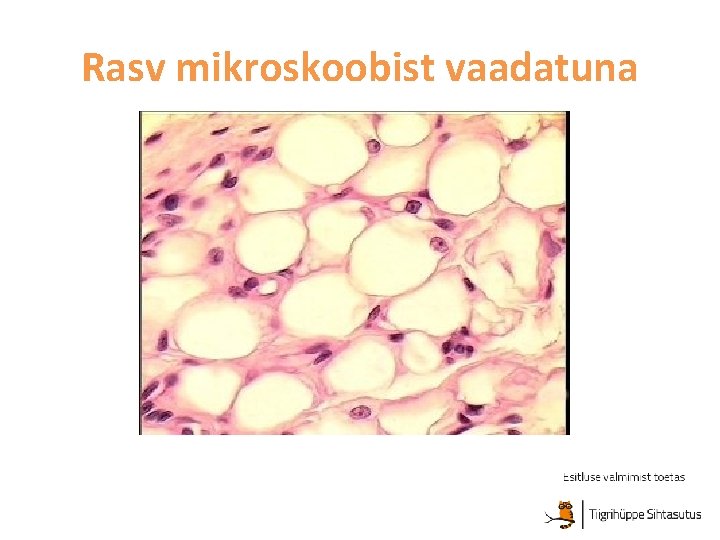 Rasv mikroskoobist vaadatuna 