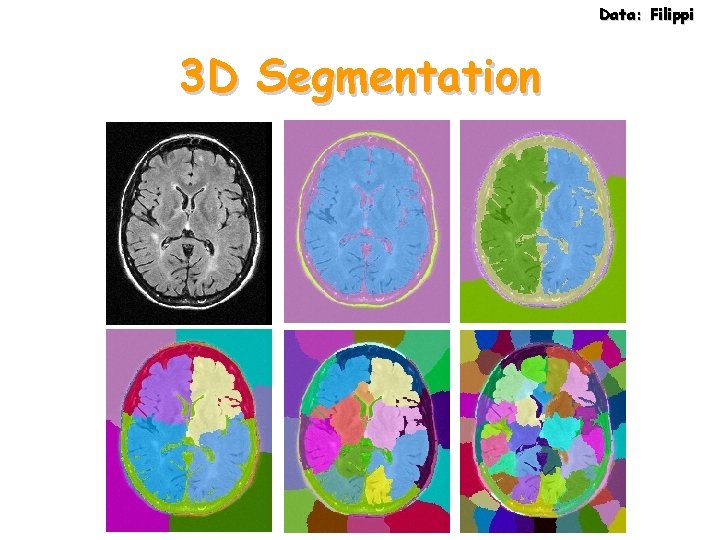 Data: Filippi 3 D Segmentation 