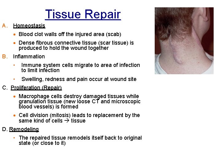 Tissue Repair A. Homeostasis · Blood clot walls off the injured area (scab) ·