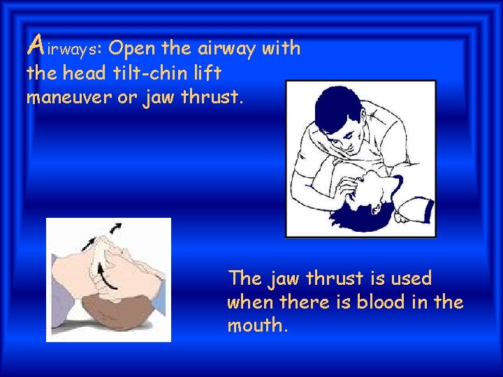 Airways: Open the airway with the head tilt-chin lift maneuver or jaw thrust. The