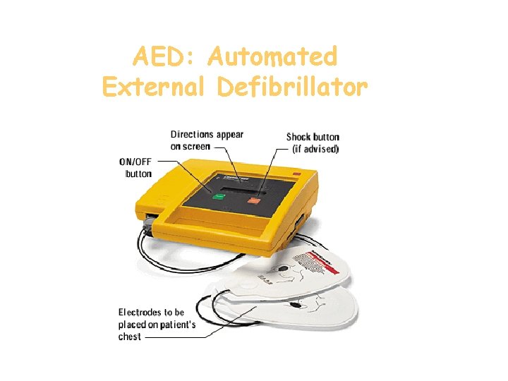 AED: Automated External Defibrillator 