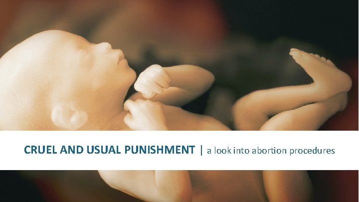 CRUEL AND USUAL PUNISHMENT | a look into abortion procedures 