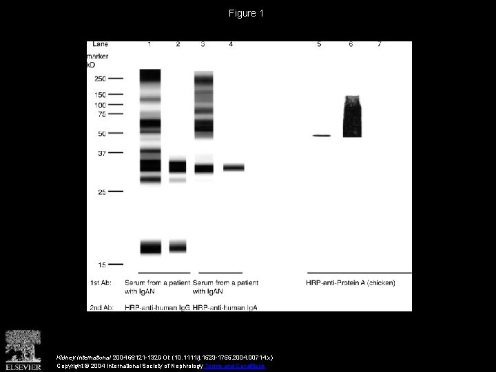 Figure 1 Kidney International 2004 66121 -132 DOI: (10. 1111/j. 1523 -1755. 2004. 00714.