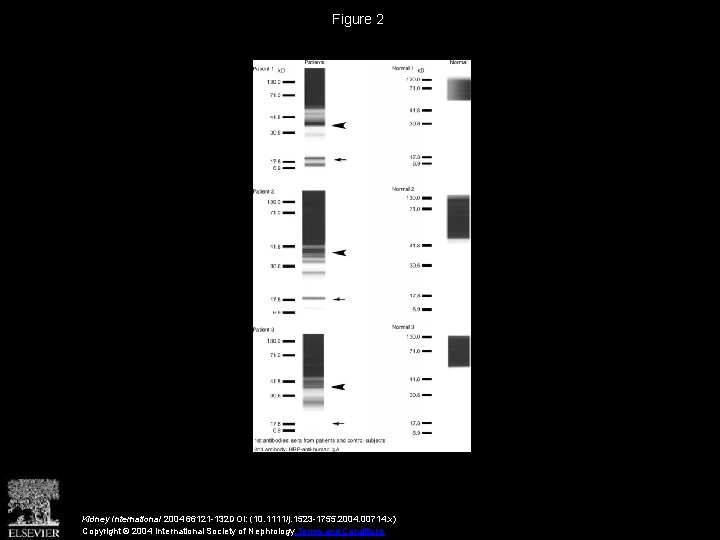 Figure 2 Kidney International 2004 66121 -132 DOI: (10. 1111/j. 1523 -1755. 2004. 00714.