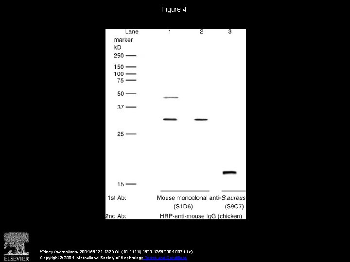 Figure 4 Kidney International 2004 66121 -132 DOI: (10. 1111/j. 1523 -1755. 2004. 00714.